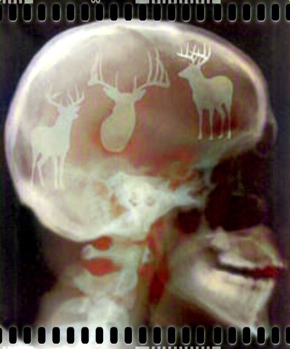 BRAIN_colorSAI_result.jpg